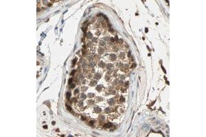 Immunohistochemistry (IHC) image for anti-Mitogen-Activated Protein Kinase 3 (MAPK3) (pThr202), (pTyr204) antibody (ABIN6256503)