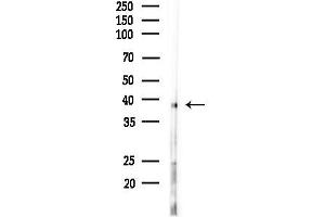 anti-Protein Phosphatase 1, Regulatory Subunit 3C (PPP1R3C) (N-Term) antibody