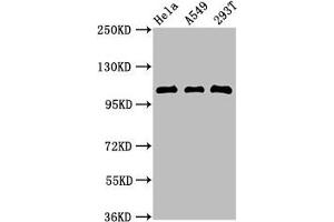 Western Blot Positive WB detected in: Hela whole cell lysate, A549 whole cell lysate, 293T whole cell lysate All lanes:ECT2 antibody at 2.