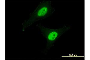 Immunofluorescence of monoclonal antibody to CAPN3 on HeLa cell.