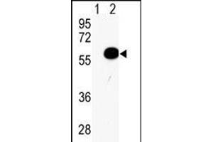 Western blot analysis of AKT2 (arrow) using rabbit polyclonal AKT2 Antibody (Center) (ABIN391023 and ABIN2841193). (AKT2 antibody  (AA 93-123))