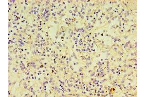 Immunohistochemistry of paraffin-embedded human spleen tissue using ABIN7174112 at dilution of 1:100