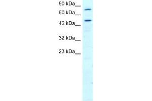 RGS9 antibody used at 2 ug/ml to detect target protein. (RGS antibody  (N-Term))