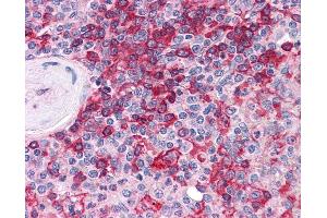 Immunohistochemistry (IHC) image for anti-Membrane Protein, Palmitoylated 5 (MAGUK P55 Subfamily Member 5) (MPP5) (AA 124-187) antibody (ABIN604916)