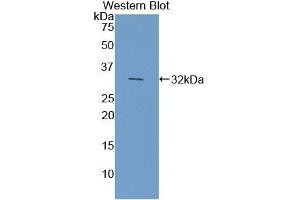 Detection of Recombinant CYP7A1, Mouse using Polyclonal Antibody to Cytochrome P450 7A1 (CYP7A1) (CYP7A1 antibody  (AA 227-467))