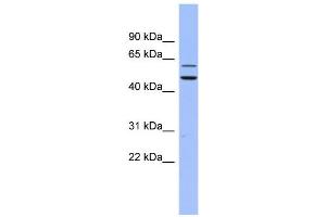 WB Suggested Anti-DKC1 Antibody Titration:  0. (DKC1 antibody  (N-Term))