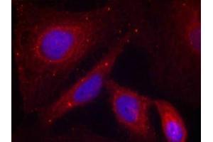 Immunofluorescence staining of methanol-fixed Hela cells using PAK1(Phospho-Thr212) Antibody. (PAK1 antibody  (pThr212))