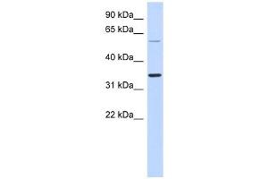SASP antibody used at 1 ug/ml to detect target protein. (ASPRV1 antibody  (Middle Region))