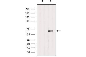 Western blot analysis of extracts from 3T3, using SERPINH1 Antibody. (SERPINH1 antibody  (Internal Region))