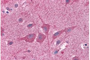 Human Brain, Cortex: Formalin-Fixed, Paraffin-Embedded (FFPE) (NUMB antibody  (AA 1-214))