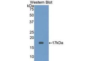 Western Blotting (WB) image for anti-CD3d Molecule, delta (CD3-TCR Complex) (CD3D) (AA 18-113) antibody (ABIN3205929)