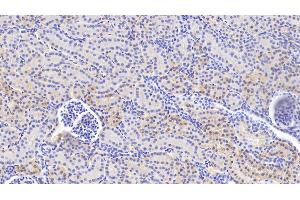 Detection of VCL in Human Kidney Tissue using Anti-Vinculin (VCL) Polyclonal Antibody (Vinculin antibody  (AA 1020-1134))