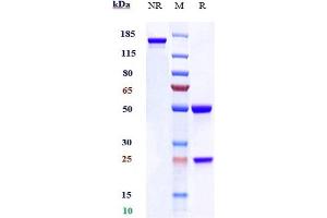 Anti-ACVR1 / ALK-2 Reference Antibody (DS-6016a) on SDS-PAGE under reducing (R) condition.