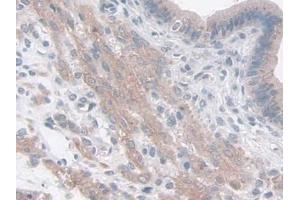 IHC-P analysis of Mouse Uterus Tissue, with DAB staining. (FAM3B antibody  (AA 30-235))