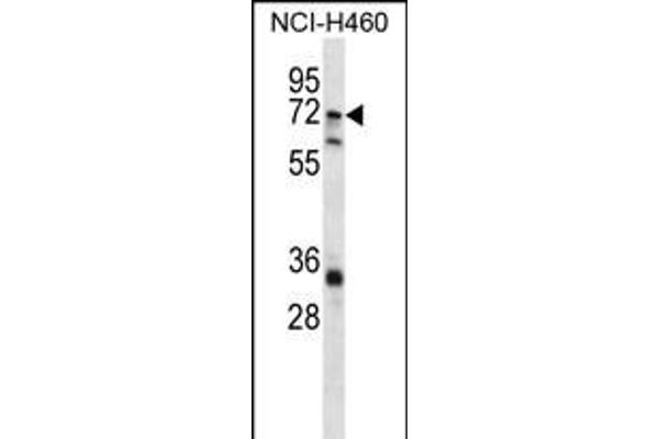 ST6GALNAC1 antibody  (N-Term)