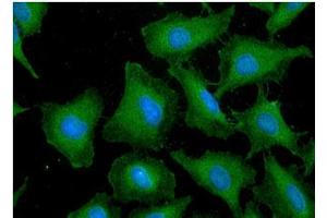 ICC/IF analysis of GST in HeLa cells line, stained with DAPI (Blue) for nucleus staining and monoclonal anti-human GST antibody (1:100) with goat anti-mouse IgG-Alexa fluor 488 conjugate (Green). (GST antibody)