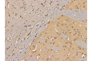 ABIN7094627 and ABIN7098677 at 1/100 staining rat brain tissue by IHC-P.