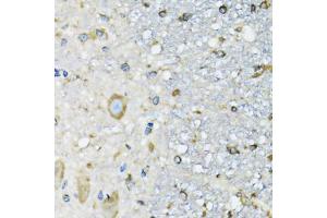 Immunohistochemistry of paraffin-embedded mouse spinal cord using DARS antibody (ABIN5973949) at dilution of 1/100 (40x lens). (DARS antibody)