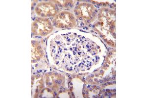 SLCO4C1 Antibody immunohistochemistry analysis in formalin fixed and paraffin embedded human kidney tissue followed by peroxidase conjugation of the secondary antibody and DAB staining. (SLCO4C1 antibody  (C-Term))