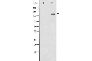 Western blot analysis of FAK phosphorylation expression in HepG2 whole cell lysates,The lane on the left is treated with the antigen-specific peptide. (FAK antibody  (pTyr861))
