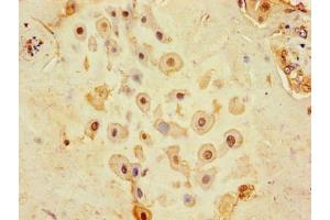 Immunohistochemistry of paraffin-embedded human placenta tissue using ABIN7147190 at dilution of 1:100 (CD9 antibody  (AA 112-195))