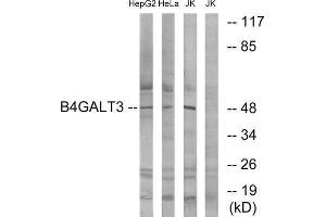 Western Blotting (WB) image for anti-UDP-Gal:betaGlcNAc beta 1,4- Galactosyltransferase, Polypeptide 3 (B4GALT3) (Internal Region) antibody (ABIN1850910) (B4GALT3 antibody  (Internal Region))