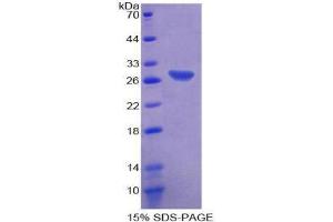 SDS-PAGE (SDS) image for CD72 Molecule (CD72) (AA 143-345) protein (His tag) (ABIN2124391)