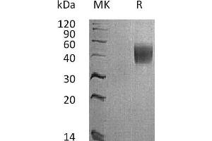 Western Blotting (WB) image for Interleukin 4 Receptor (IL4R) (Active) protein (His tag) (ABIN7320981) (IL4 Receptor Protein (His tag))