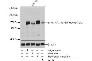 Western blot analysis of extracts of C2C12 cells using Phospho-PRKAA1(T183)/PRKAA2(T172) Polyclonal Antibody at dilution of 1:2000. (PRKAA1 antibody  (pThr172, pThr183))