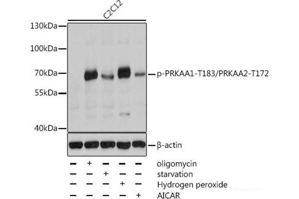 PRKAA1 Antikörper  (pThr172, pThr183)