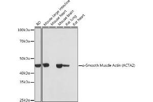 Western blot analysis of extracts of various cell lines, using α-Smooth Muscle Actin  antibody (ABIN7265392) at 1:1000 dilution. (Smooth Muscle Actin antibody)