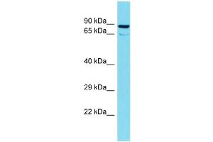 Host: Rabbit Target Name: TTLL10 Sample Type: 721_B Whole Cell lysates Antibody Dilution: 1. (TTLL10 antibody  (N-Term))