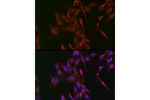 Immunofluorescence analysis of C6 cells using LOX Rabbit pAb (ABIN6133805, ABIN6143288, ABIN6143289 and ABIN6223629) at dilution of 1:100 (40x lens). (LOX antibody)