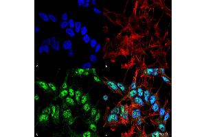 Immunocytochemistry/Immunofluorescence analysis using Rabbit Anti-Beclin 1 Polyclonal Antibody . (Beclin 1 antibody  (FITC))
