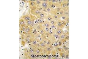 Immunohistochemistry (Paraffin-embedded Sections) (IHC (p)) image for anti-Connective Tissue Growth Factor (CTGF) (AA 315-349), (C-Term) antibody (ABIN392204)