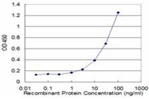 Detection limit for recombinant GST tagged ACAT2 is approximately 1ng/ml as a capture antibody. (ACAT2 antibody  (AA 1-397))