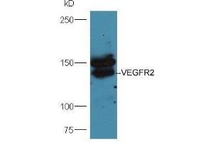 Mouse lung lysates probed with Anti-VEGFR2 Polyclonal Antibody  at 1:5000 90min in 37˚C. (VEGFR2/CD309 antibody  (AA 101-200))