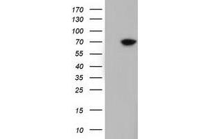 Image no. 5 for anti-EPM2A (Laforin) Interacting Protein 1 (EPM2AIP1) antibody (ABIN1498047) (EPM2AIP1 antibody)