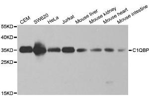 Western blot analysis of extracts of various cell lines, using C1QBP antibody. (C1QBP antibody  (AA 74-282))