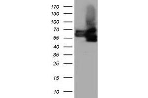 HEK293T cells were transfected with the pCMV6-ENTRY control (Left lane) or pCMV6-ENTRY BTN1A1 (Right lane) cDNA for 48 hrs and lysed. (BTN1A1 antibody)