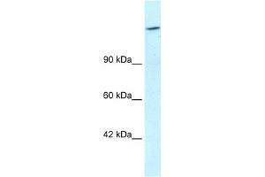 WB Suggested Anti-ARID4A Antibody Titration:  1. (ARID4A antibody  (C-Term))