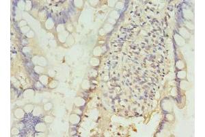 Immunohistochemistry of paraffin-embedded human small intestine tissue using ABIN7164683 at dilution of 1:100 (PD-1 antibody  (AA 21-170))