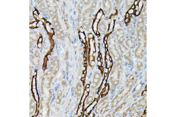 AQP3 antibody  (AA 178-292)
