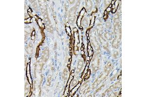 Immunohistochemistry of paraffin-embedded mouse kidney using  Rabbit pAb (ABIN3016811, ABIN3016812, ABIN3016813, ABIN1678723 and ABIN6219847) at dilution of 1:50 (40x lens). (AQP3 antibody  (AA 178-292))