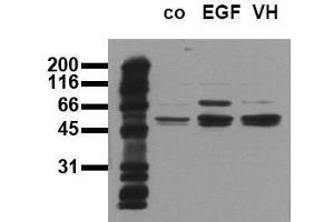 Western Blotting (WB) image for anti-SHC (Src Homology 2 Domain Containing) Transforming Protein 1 (SHC1) (pTyr317) antibody (ABIN126889) (SHC1 antibody  (pTyr317))