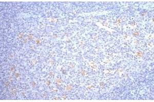 Immunohistochemistry of paraffin-embedded Human tonsil tissue using CD68 Monoclonal Antibody at dilution of 1:200. (CD68 antibody)