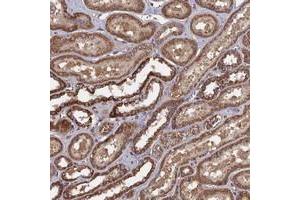 Immunohistochemical staining of human kidney with SPANXN4 polyclonal antibody  shows strong cytoplasmic positivity in cells of tubules at 1:10-1:20 dilution. (SPANXN4 antibody)