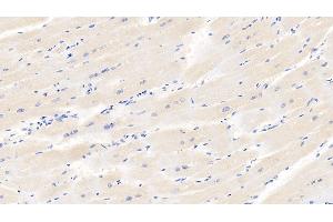 Immunohistochemistry (IHC) image for anti-Hypoxia Inducible Factor 1, alpha Subunit (Basic Helix-Loop-Helix Transcription Factor) (HIF1A) (AA 575-826) antibody (ABIN7428677)