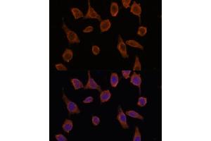 Immunofluorescence analysis of L929 cells using TMED2 antibody (ABIN7270943) at dilution of 1:100. (TMED2 antibody  (AA 60-170))