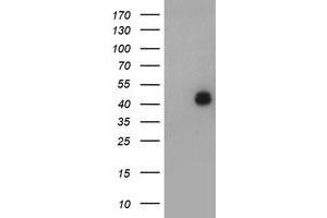 Image no. 1 for anti-LIM Homeobox 1 (LHX1) (AA 100-362) antibody (ABIN1490807) (LHX1 antibody  (AA 100-362))